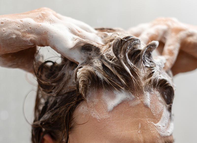 caida del pelo en hombres